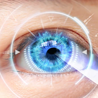 Laser Eye Surgery image
