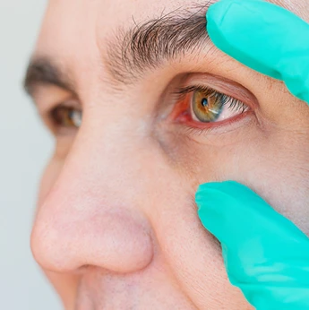 Treatment of Eye Diseases image